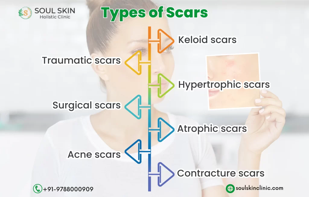 Scar Removal Treatment in Chennai