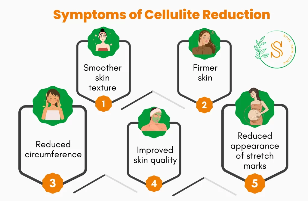 Cellulite Reduction Treatment in Chennai | Soul Skin Clinic