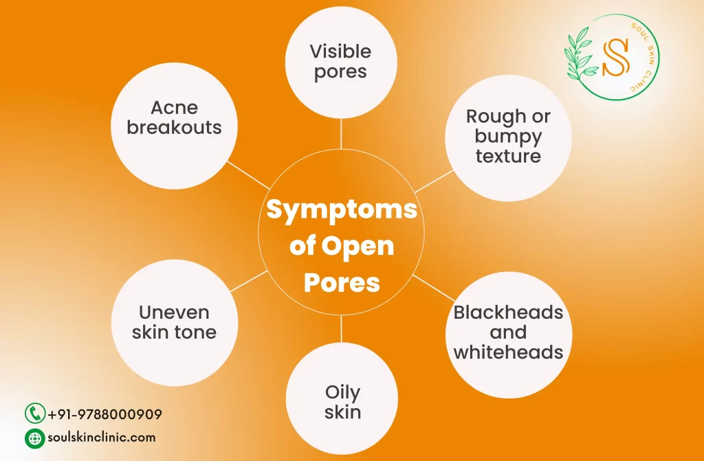 Open Pores Treatment in Chennai | Soul Skin Clinic