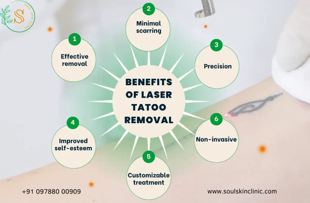 Laser Tattoo Removal in Chennai | Soul Skin Clinic