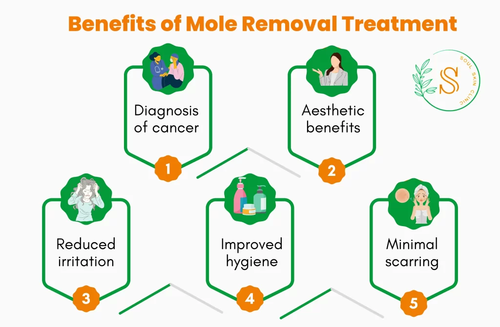 Mole Removal Treatment in Chennai | Soul Skin Clinic