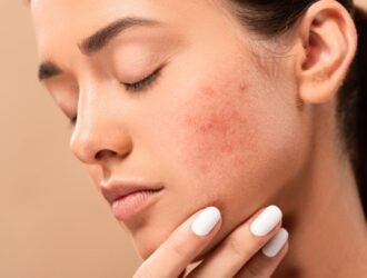 scar treatment