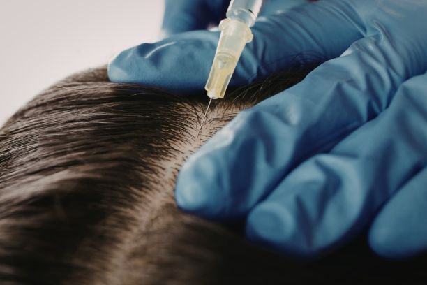 Hair Extensions in Anna Nagar