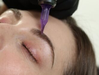 Micropigmentation Treatment in Anna Nagar