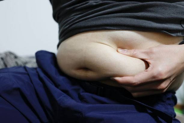 Fat Reduction Treatment in Anna Nagar | Non-Surgical