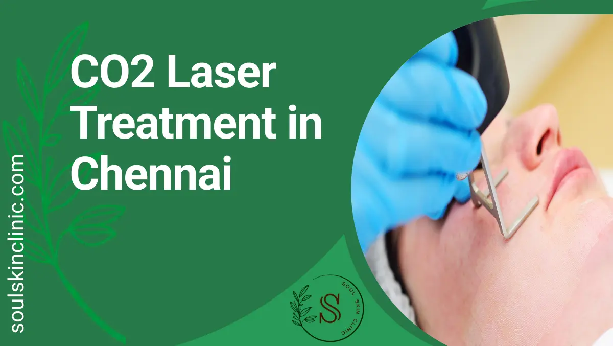 CO2 Laser Treatment in Chennai