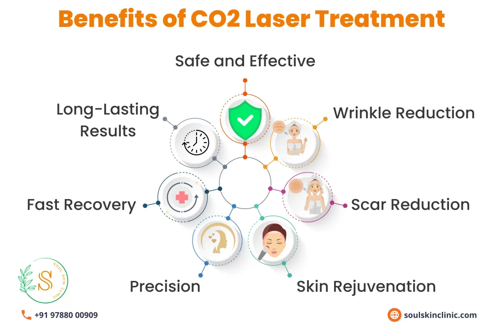 CO2 Laser Treatment in Chennai | Soul Skin Clinic