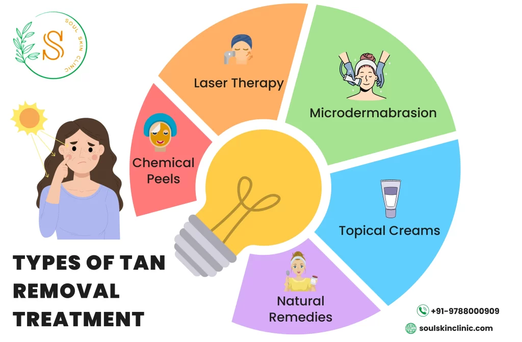 Tan Removal Treatment in Chennai