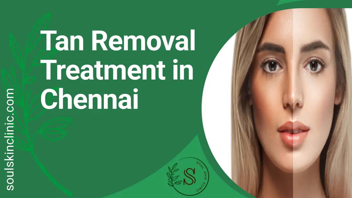 Tan Removal Treatment in Chennai | Soul Skin Clinic