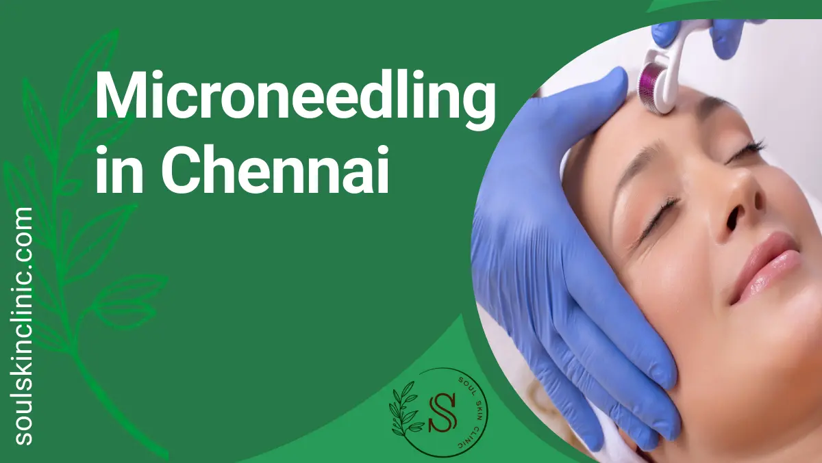 Microneedling in Chennai | Soul Skin Clinic