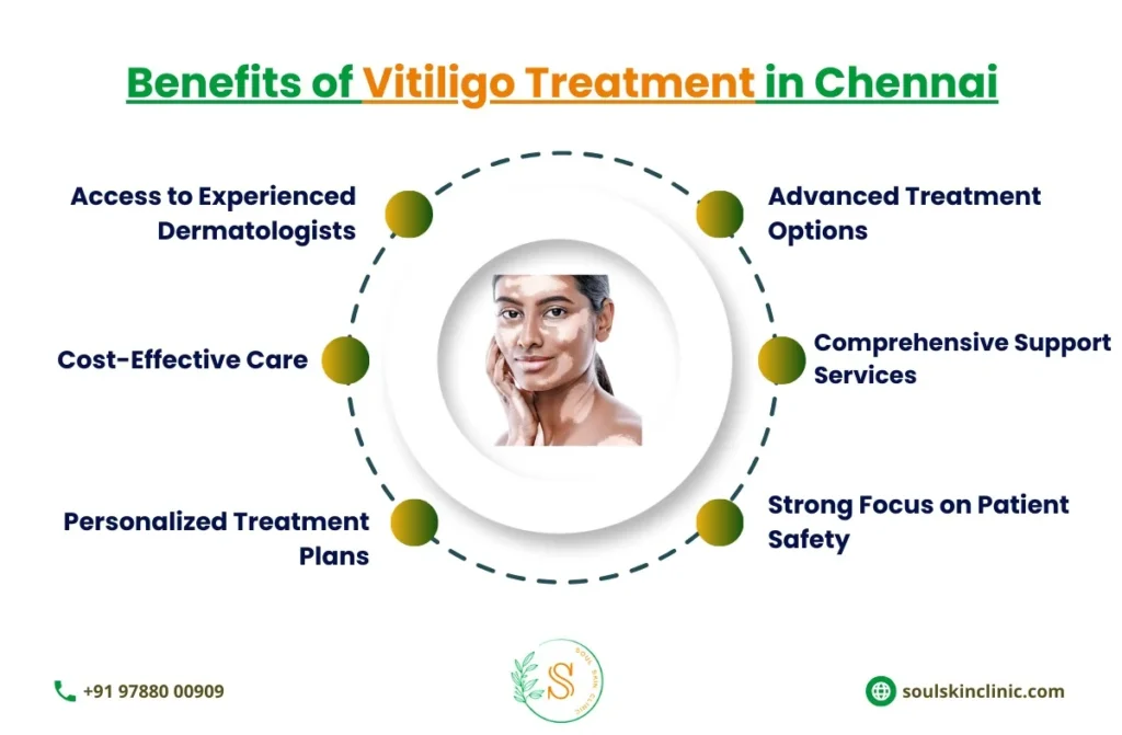 Best Vitiligo Treatment in Chennai | SoulSkin Clinic