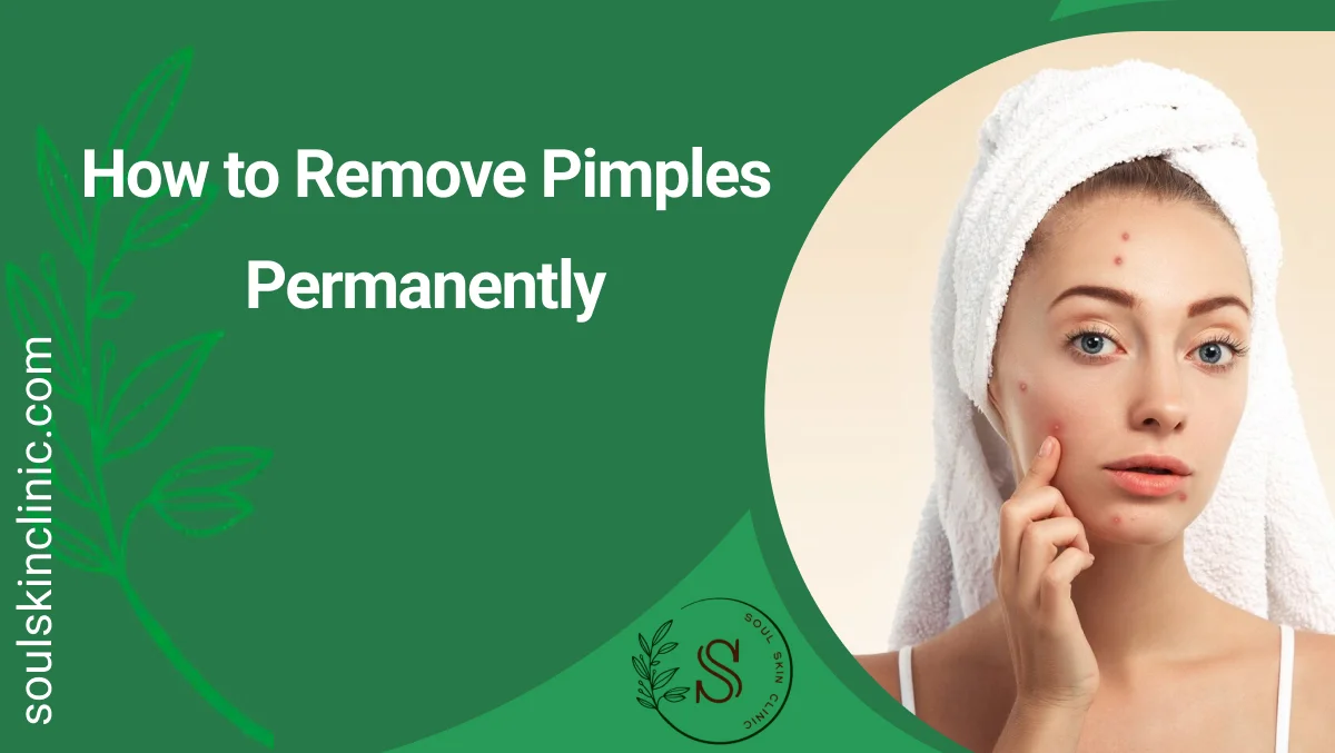 How to Remove Pimples Permanently