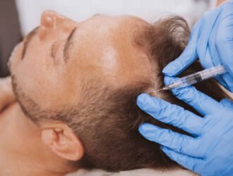 Close up of a mature man receiving hairloss treatment injections in scalp by professional trichologist. Dermatologist doing scalp injections for mature male client with alopecia problem
