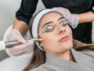 Laser Skin Resurfacing