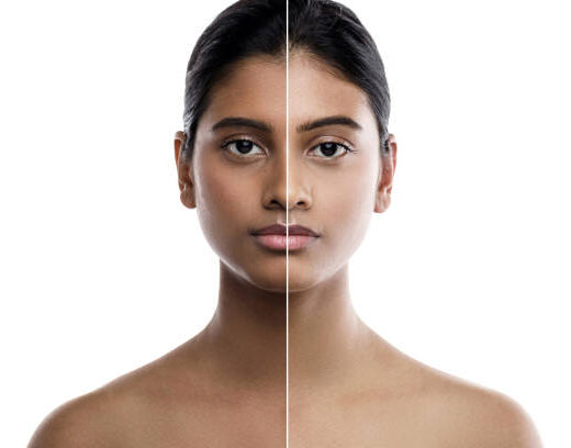 Skin Brightening Treatment