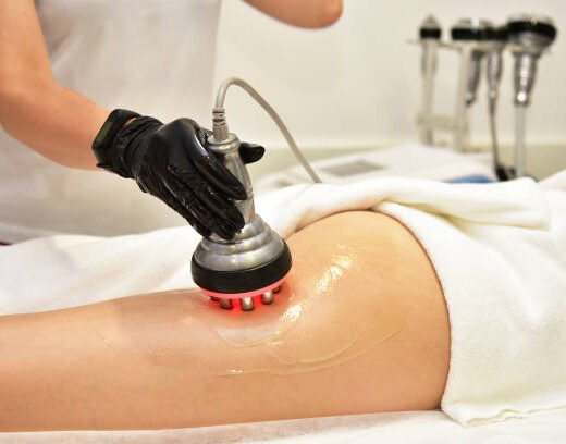 istockphoto-1332668603-612x612 Rf skin tightening. Hardware cosmetology. Ultrasound cavitation body contouring treatment, anti-cellulite and anti-fat therapy in beauty salon. Large collage with different parts of the body