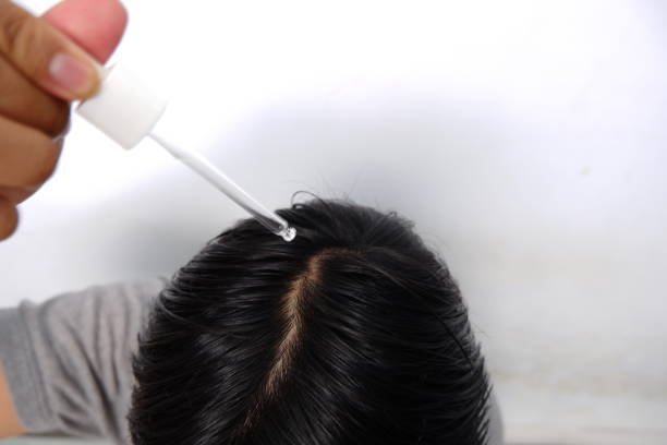 Scalp Detox (Keravive / Korean Scalp Detox