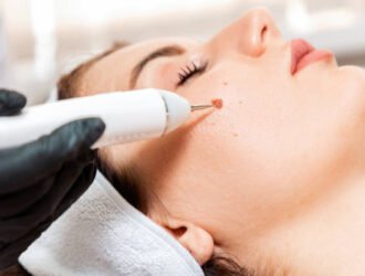 Professional salon procedures. Surgeon using a laser device for removing mole. Removal of birthmark from female face. Close up. Concept of laser cosmelotogy and electrocoagulation.