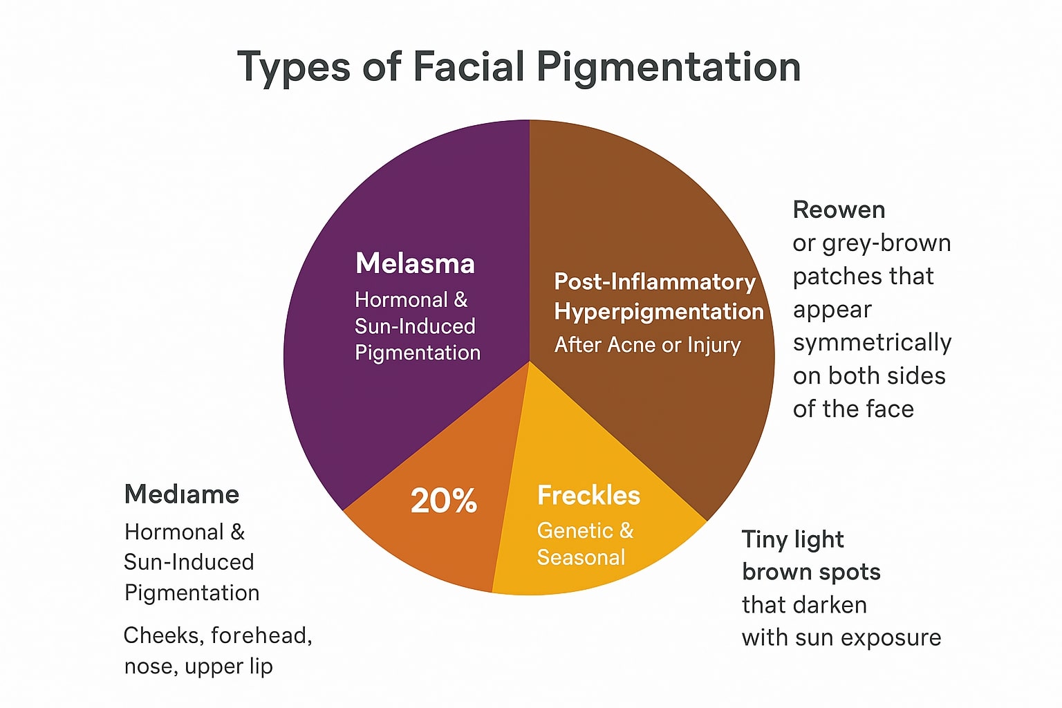 A pie chart shows types of facial pigmentation: Melasma (hormonal & sun-induced), Freckles (genetic & seasonal), Post-inflammatory hyperpigmentation (after acne or injury), and notes on reowen, medame, and acne scar treatment in Anna Nagar.