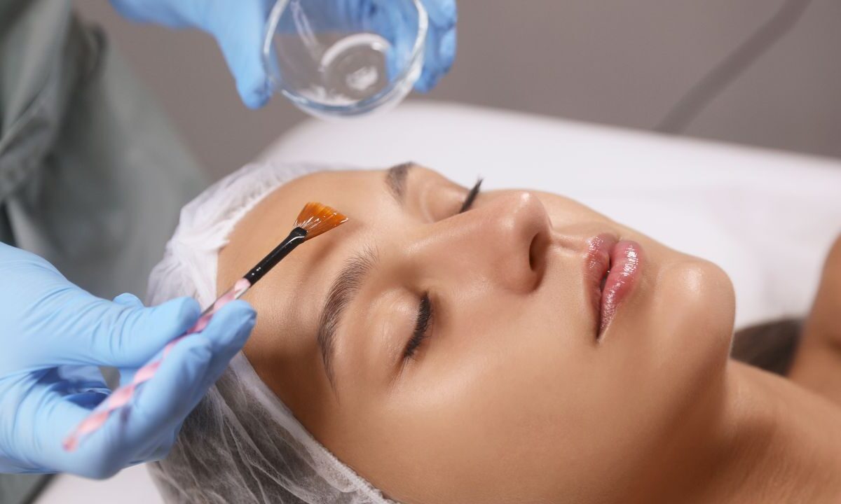 Chemical Peel Treatment in Anna Nagar