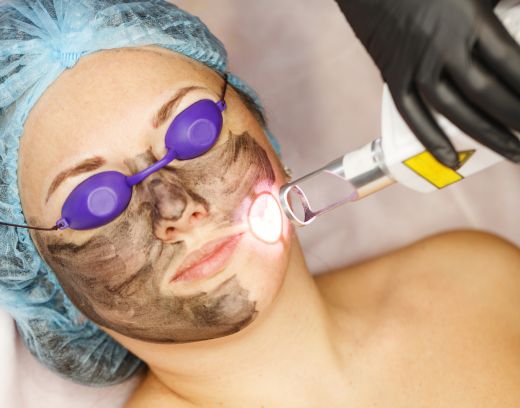 Dark Circle Treatment in Chennai: Effective Remedies & Pricing Guide