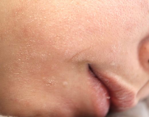 Winter Skin Care Routine for Dry Skin | Expert Tips