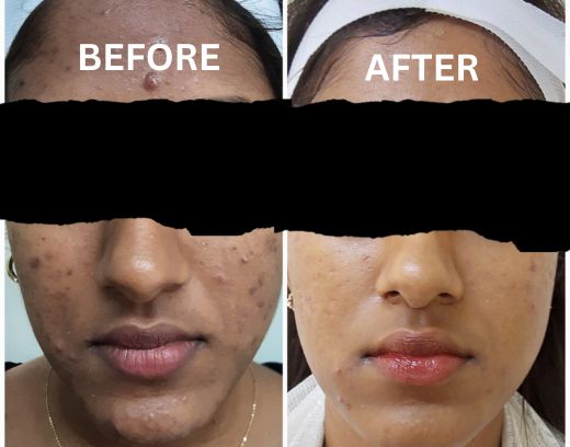 before after treatment