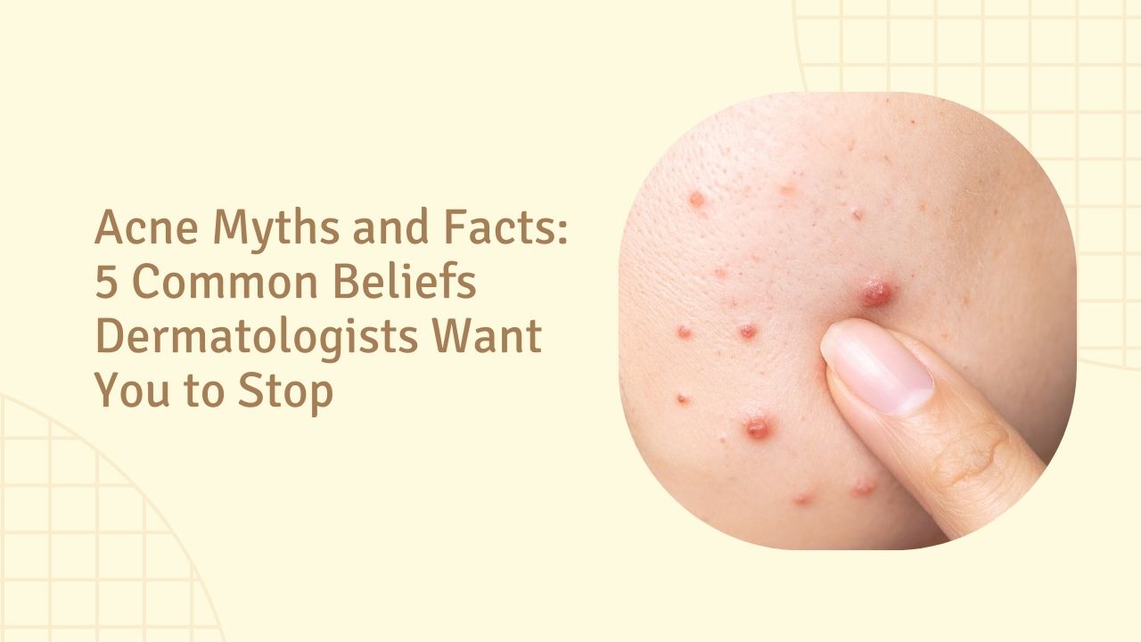 Acne Myths and Facts: What Dermatologists Want You to Know