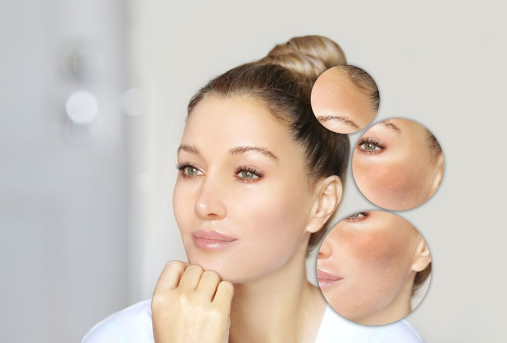 Dermatologist Near Korattur | Soul Skin Clinic