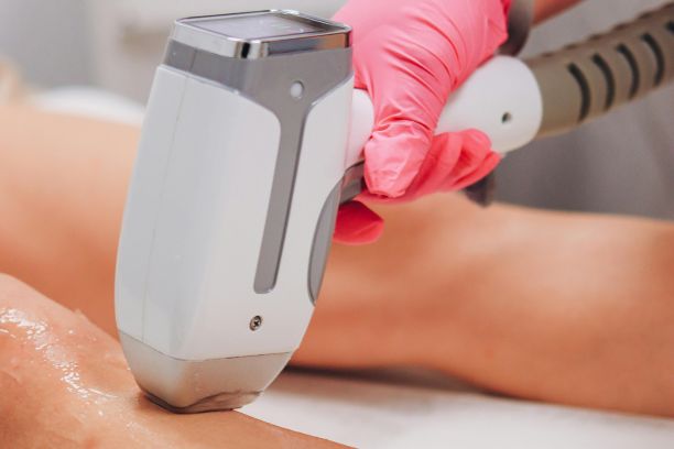 Laser Skin Resurfacing in Anna Nagar