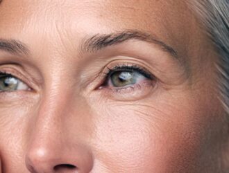 Anti-Aging Treatment in Anna Nagar | Advanced Skin Rejuvenation at Soul Skin Clinic