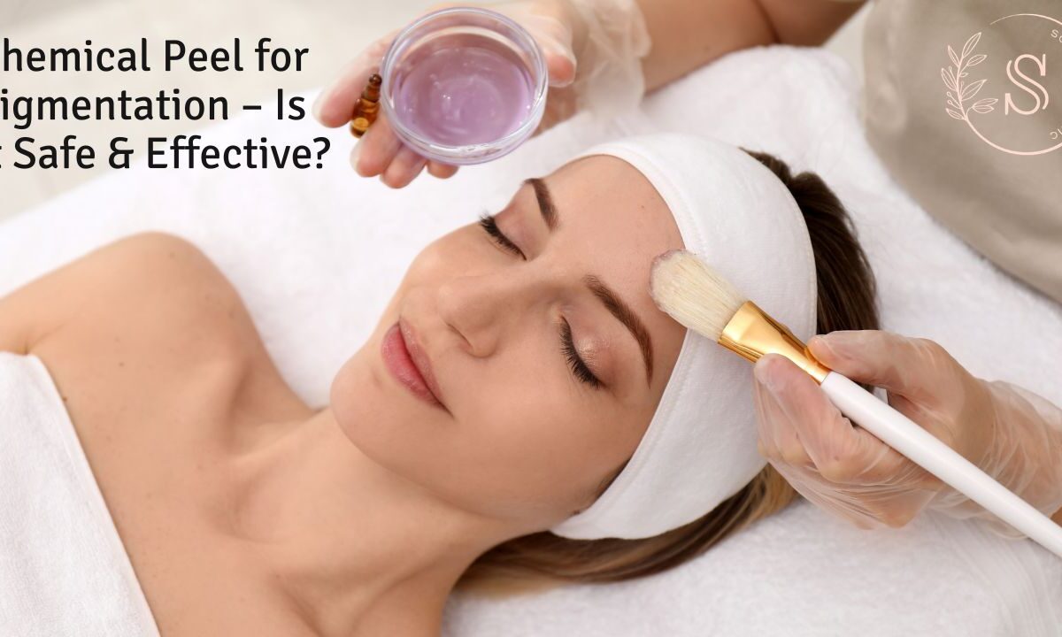 Chemical Peel for Pigmentation – Is It Safe & Effective