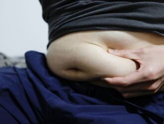 Fat Reduction Treatment in Anna Nagar | Non-Surgical